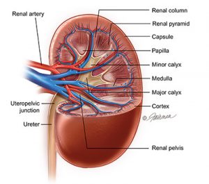 kidney disease